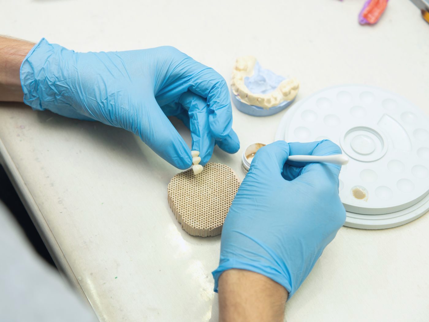 Implants & Restorations at Bayview Dental Studio