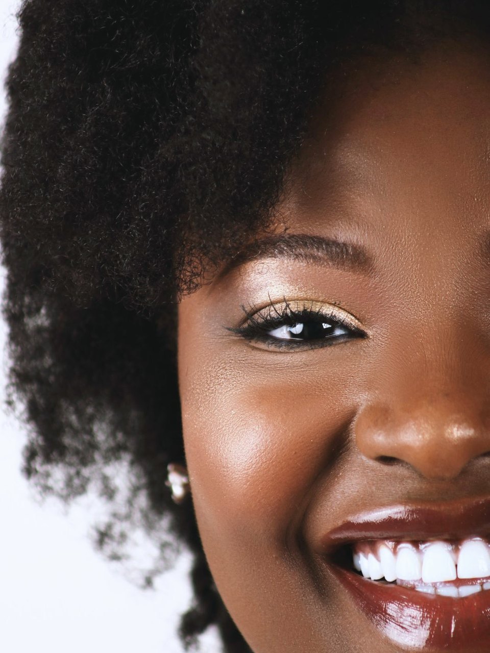 A close-up of an easy smile with an even, healthy gum line